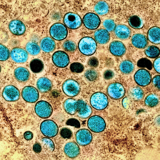 Monkeypox - teal
